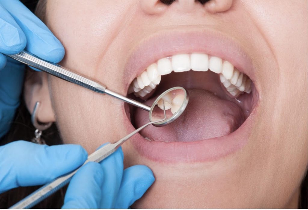 algemene-tandheelkunde